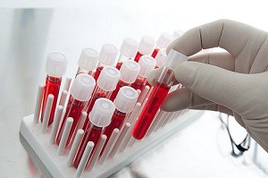 Blood samples in test-tubes